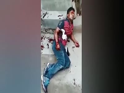 Man With Knife Still Stuck in His Chest Bleeding to Death 