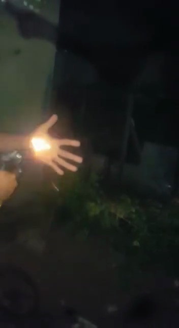 Thief Shot in the Hand in Favela