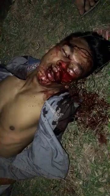 Man Dying Taking His Final Gasps of Air