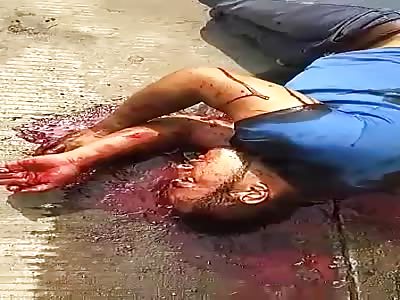 Thief Losing a Lot of Blood After Getting Shot by Victim