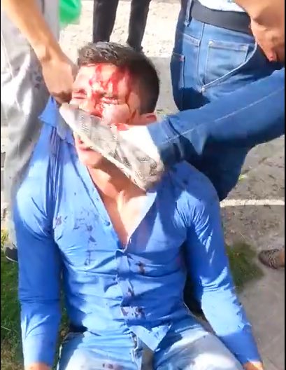 Bloodied Bike Thief Brutally Beaten