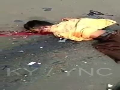 Two Schoolkid Bikers Died Brutally