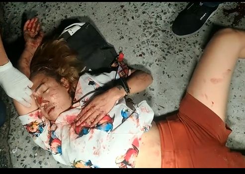 Young Woman Agonizes After Accident