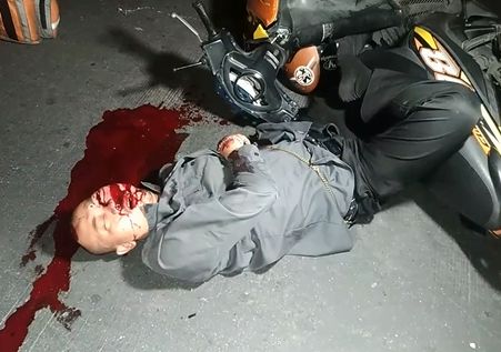 Biker Agonizes in a Pool of His Blood