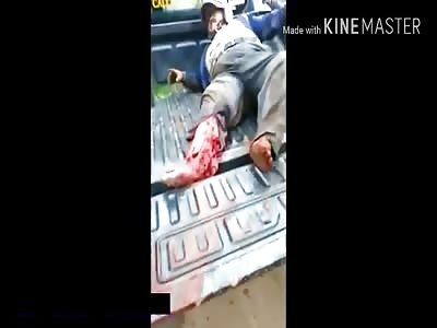 Motorcyclist In Agony With Leg Ripped to The Bone