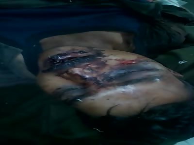 Sewing Up man With Battered Face