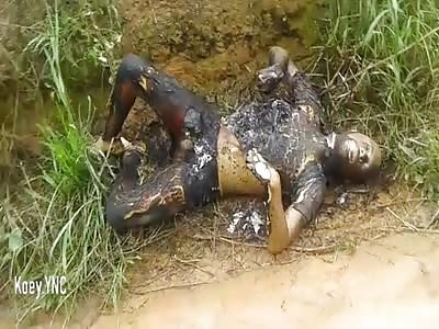 Man Was Brutally Burned to a Crisp