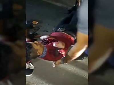 Biker Agonizing With Arm Torn to the Bone