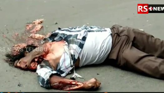 Biker Left Unrecognisable in Uppal