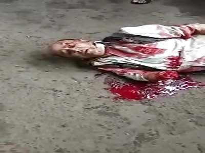 Old Man Agonizing and Bleeding to Death With Hand Torn off From Train Accident