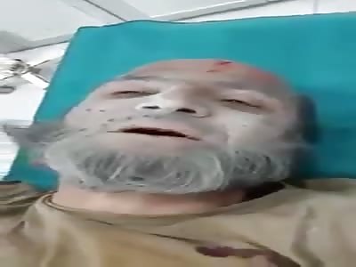 Old Man Still Alive With Feet Destroyed