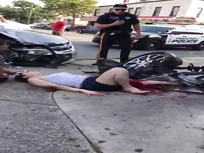 Young Woman With Horrific Leg Injury in NYC