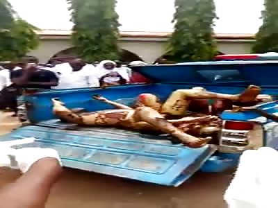 Agonizing After Gas Explosion