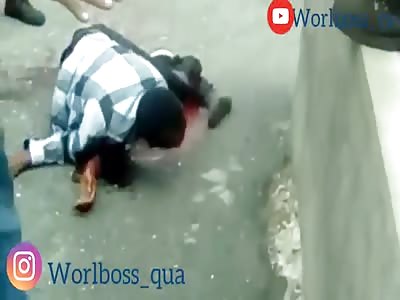 Accident Leaves Snapped Leg