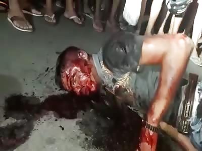 Agonizing after Being Lynched and Shot