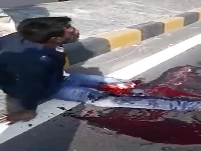 Ouch! Man Agonizing with His Leg Torn Off