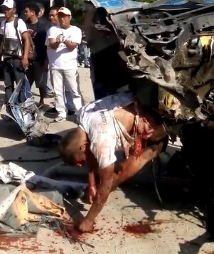Sickening Car Crash Aftermath..( Philippines)