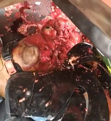 Head Blown Out an his Eye Staring out Us