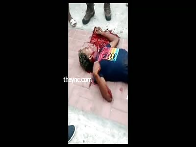 Bloody Mess in Full Agony