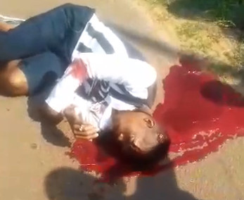 Dying Boy Bleeds out as Onlookers just Tape with Cell Phones