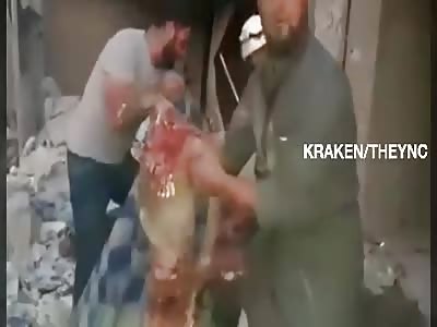 victims of air attack