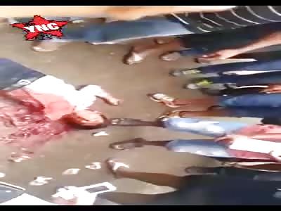 victim  brutal accident