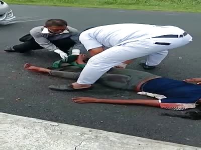 Motorcycle accident injured woman