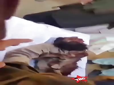 Remains of a bomb victim man