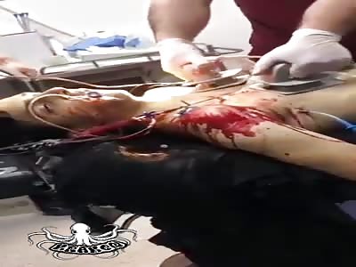 Young stabbed by military