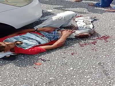 Motorcycle accident, badly injured leg