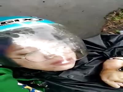 Girl with seriously injured hand