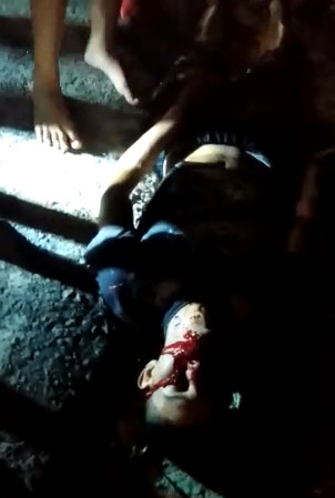 Beer, Women and a Lot of Blood (Normal in Brazilian Bars)