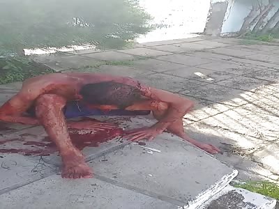 Thief attacked by pit bull