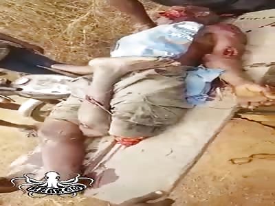 Whoa! Mutilated by Machete & Alive !