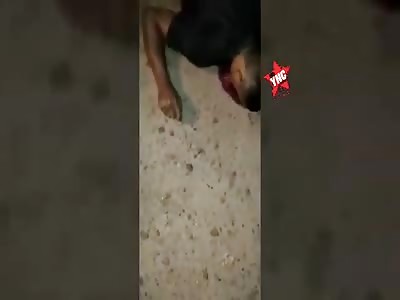 Shocking accident victim 