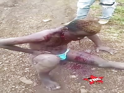 Face smashed by shot in mouth