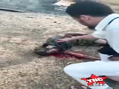 Ouch, soldier victim of land mine