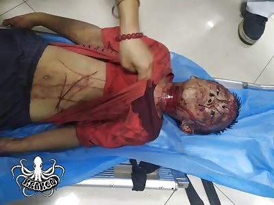 aftermath of 15 year old brutally murdered