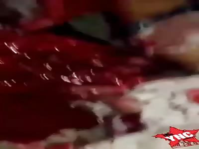 Hand Grenade Explodes in Thief's Pocket {FULL VIDEO}