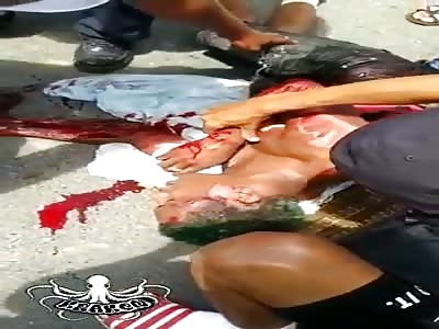 accident aftermath, consequences of clandestine races