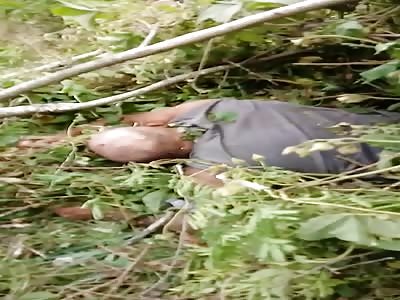 Victim of serious vehicle accident