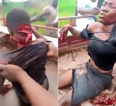 Nigerian Girl Hacked By Machete