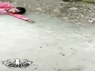 Men were hacked, seriously injured.