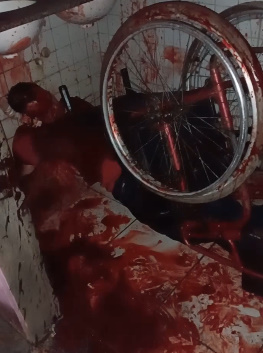 Wheelchaired Man Gunned Down in the Favela