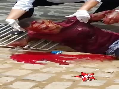 Man in agony after being shot in the head