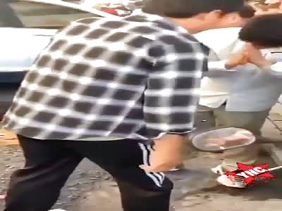 Serious drunk driver accident