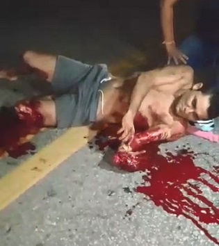 Dude Suffers Terrible Limb Injury