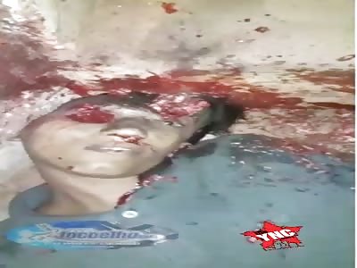 12 Shots to the Head Will do That.