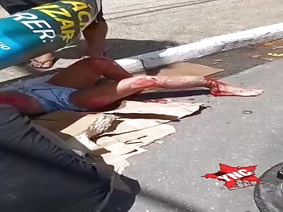 Damn my leg hurts a little