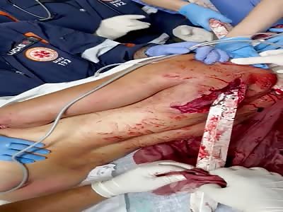 WTF How He Got Impaled Like That?